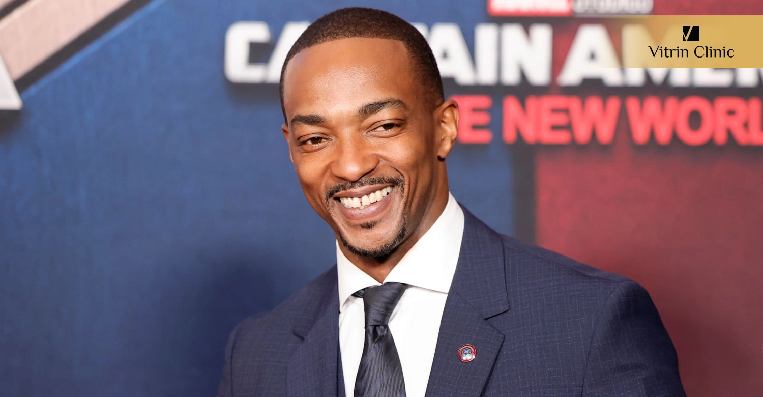 Did Anthony Mackie Get Veneers or Cosmetic Dental Work?
