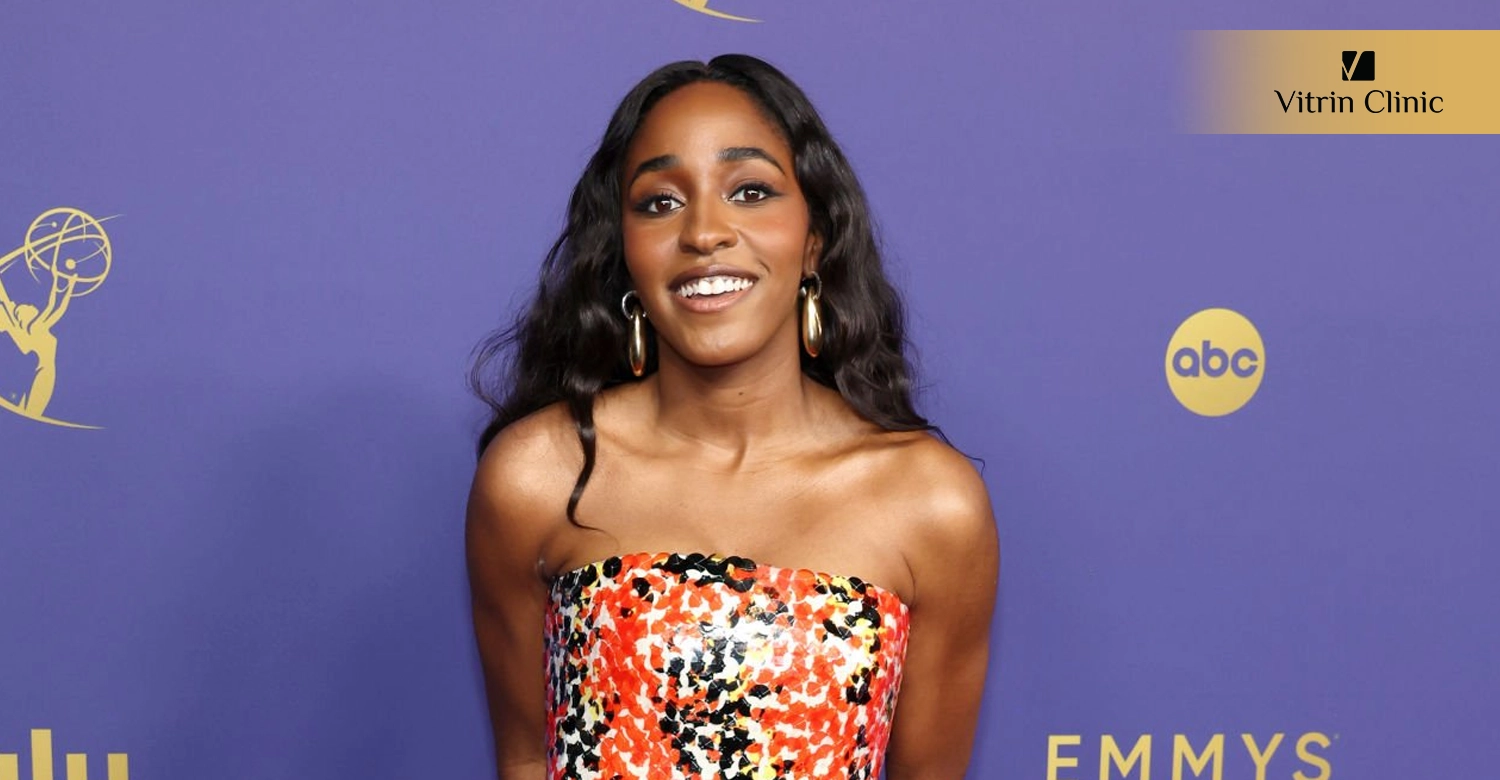 Did Ayo Edebiri Get Veneers or Cosmetic Dental Work?