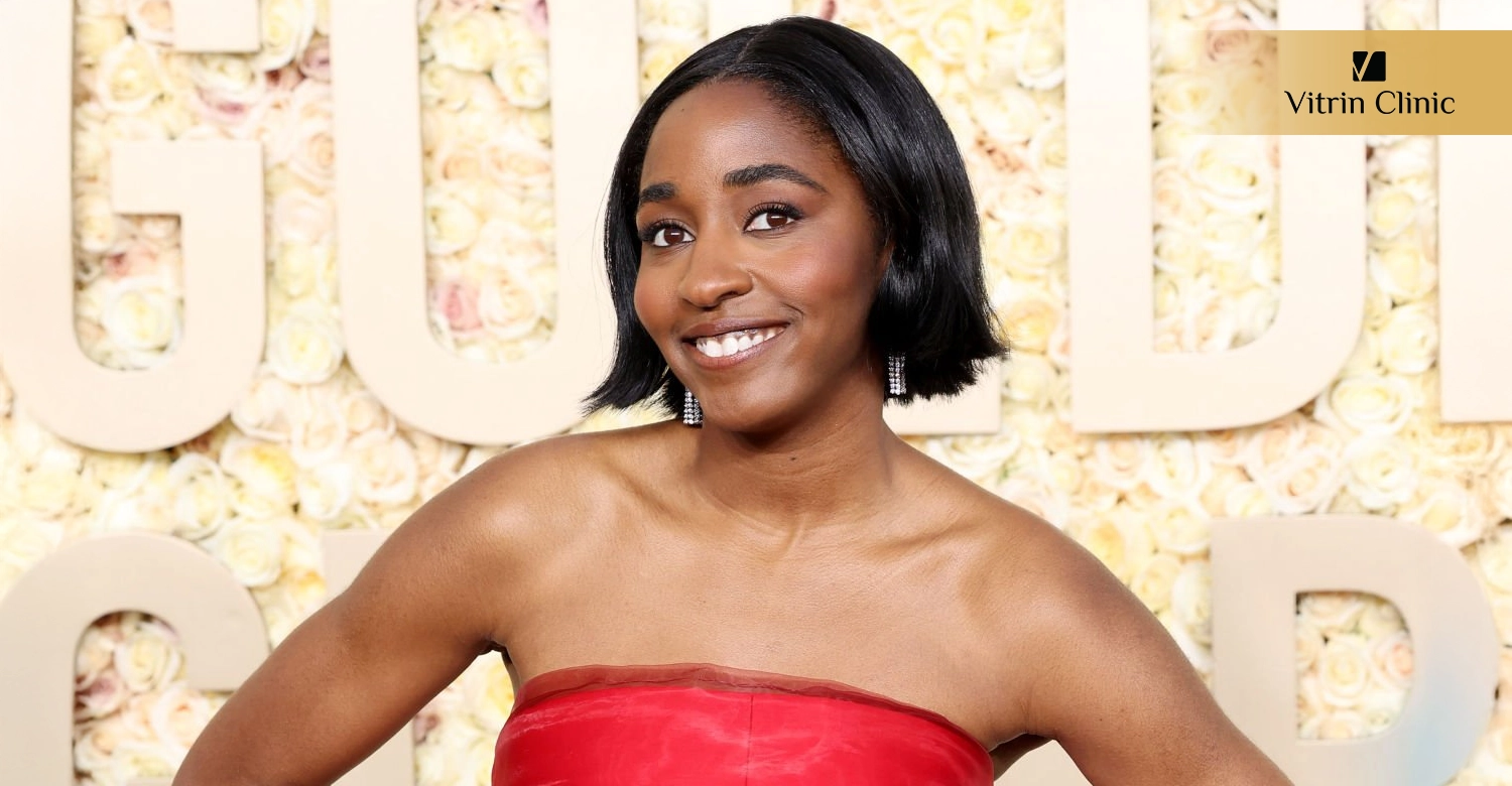 Signs of Professional Dental Work in Ayo Edebiri's Smile