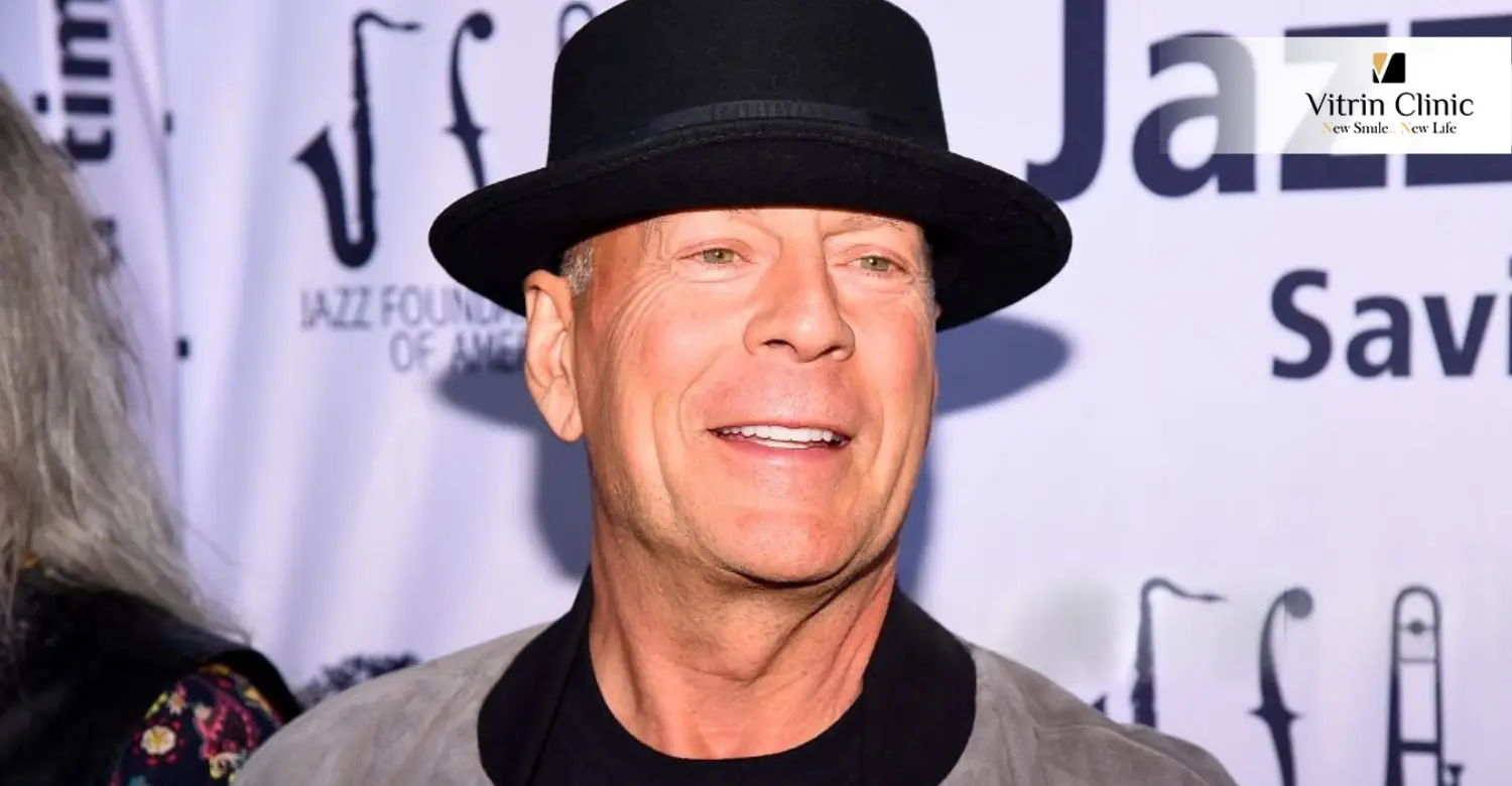 Bruce Willis teeth