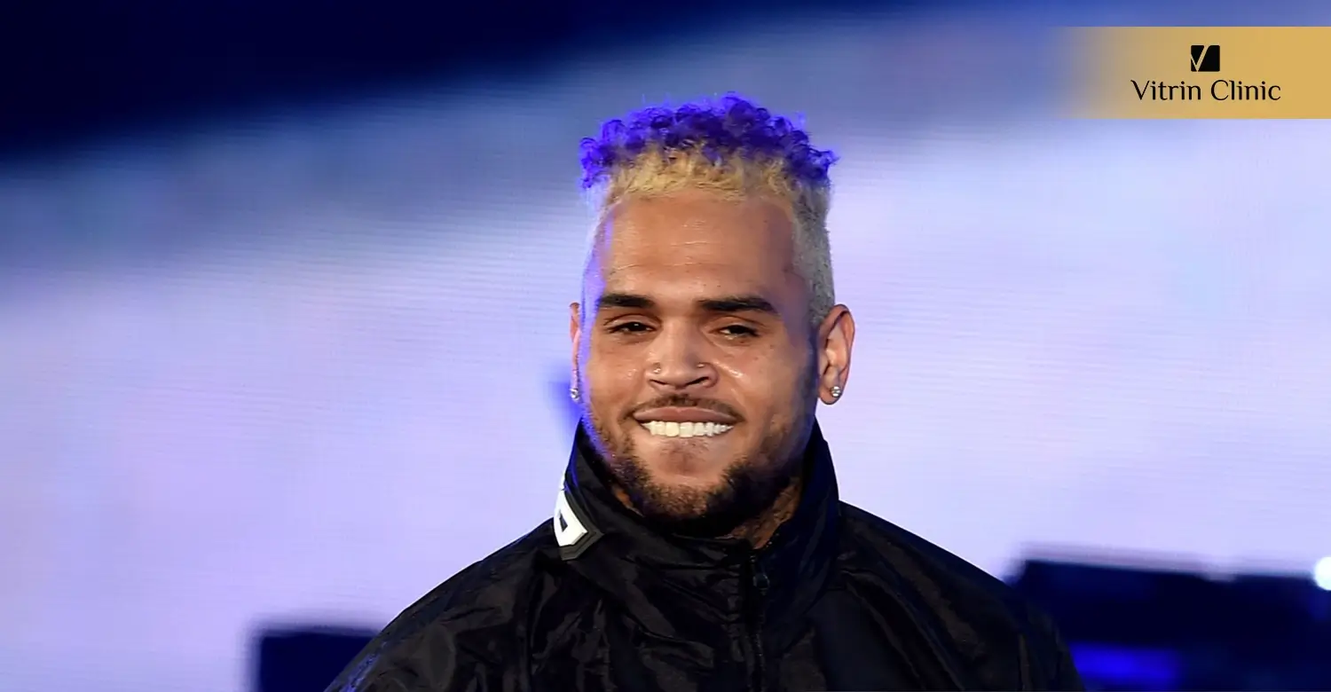 Chris Brown Original Teeth: Smile Transformation, Veneers & Hollywood Smile Explaine