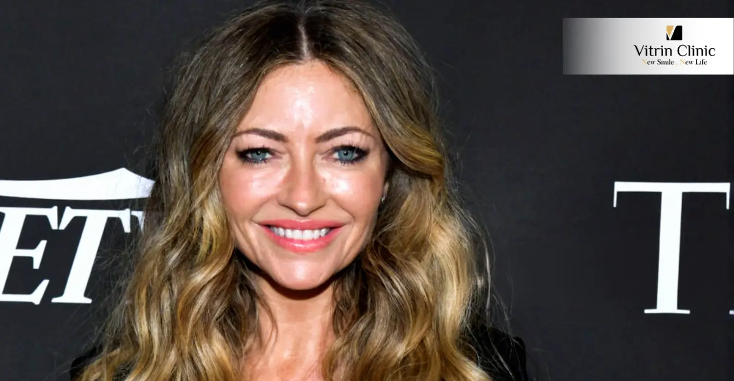 Rebecca Gayheart Teeth