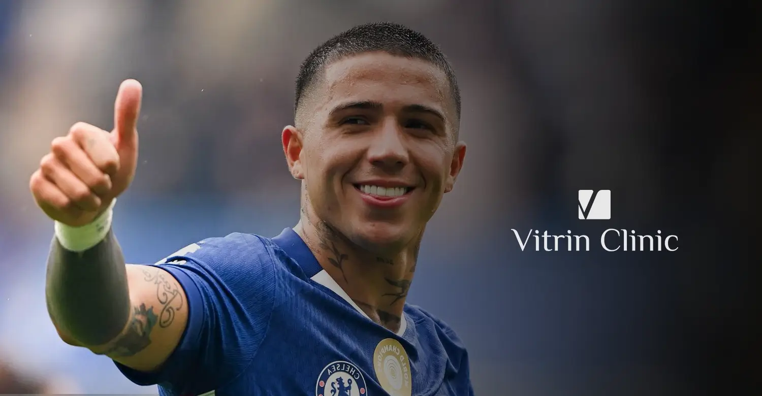 Enzo Fernández Teeth