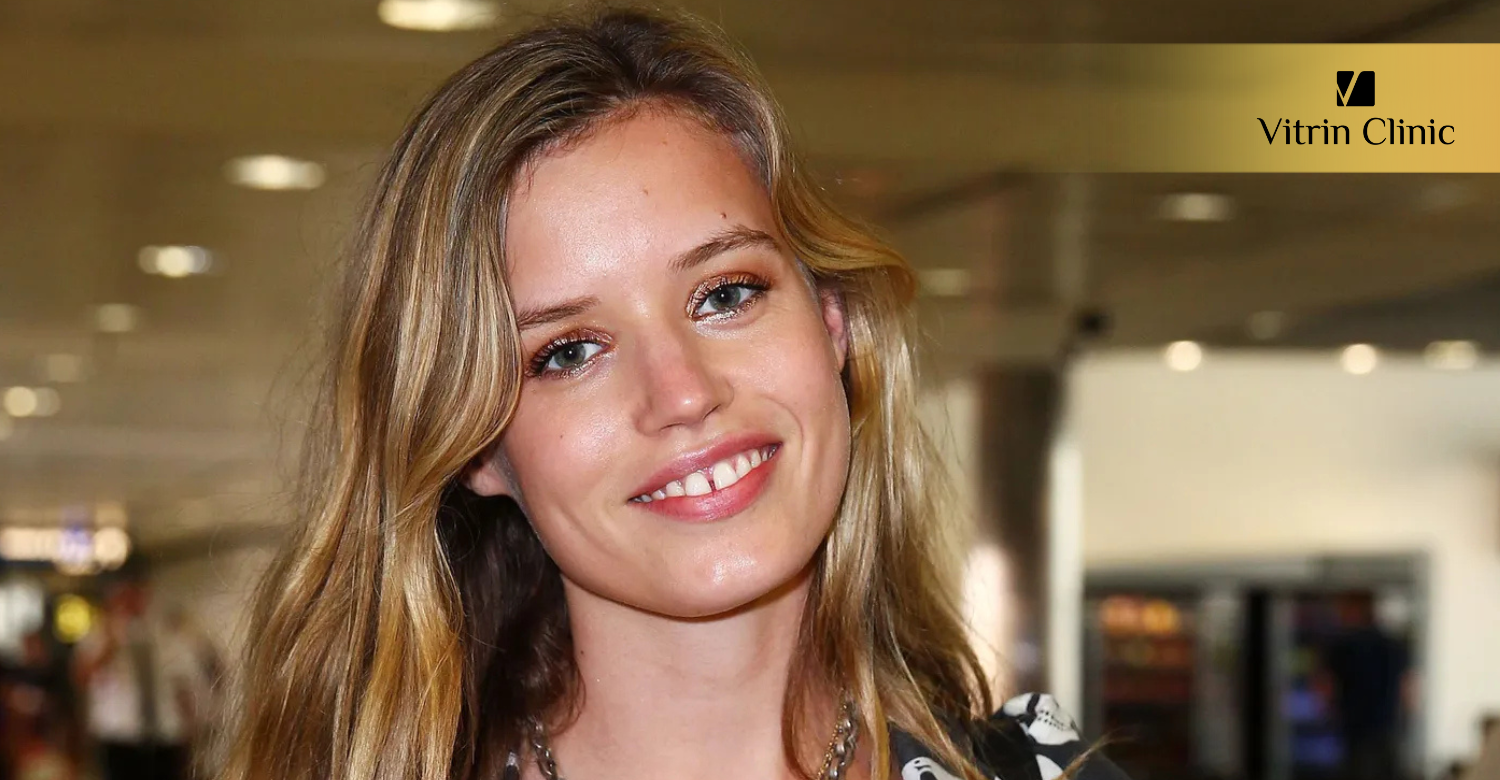 Did Georgia Jagger Get Cosmetic Dentistry or Veneers?