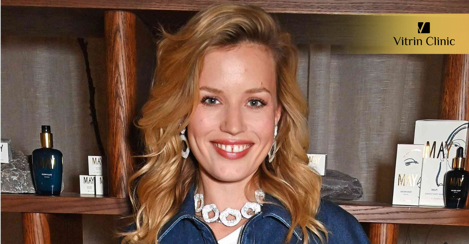 Georgia Jagger teeth