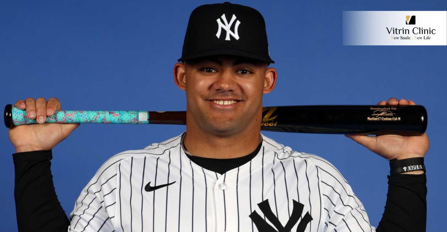 Jasson Domínguez teeth