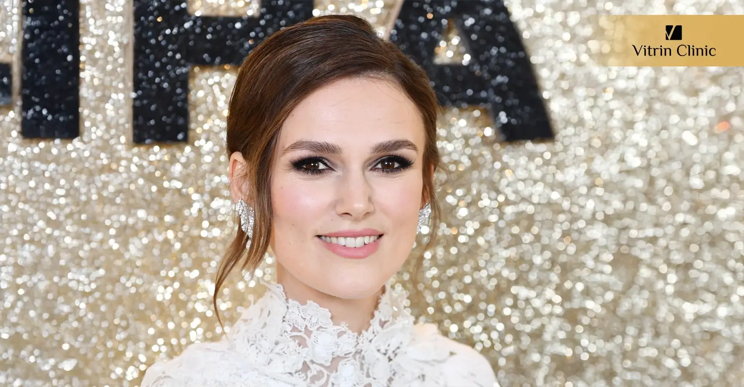 How to Maintain a Bright, Actress-Level Smile