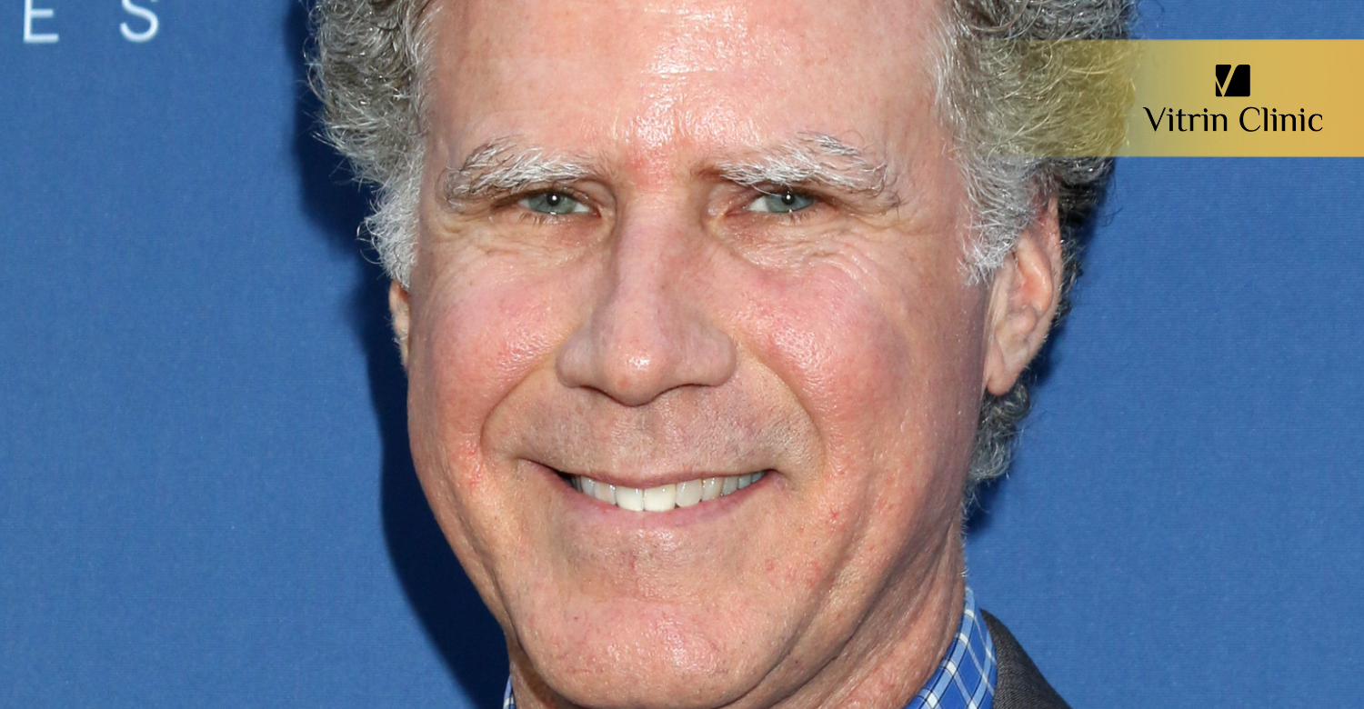 Will Ferrell Teeth