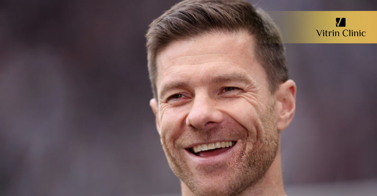 Xabi Alonso Teeth