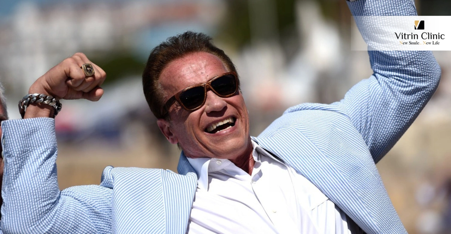 Lessons from Arnold Schwarzenegger's Smile for Everyday Confidence