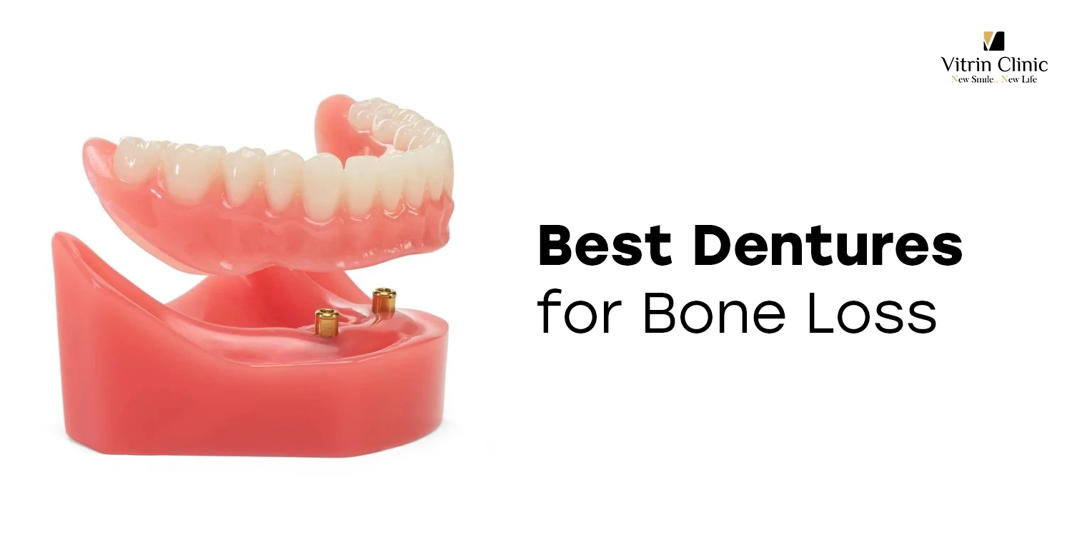Best Dentures for Bone Loss
