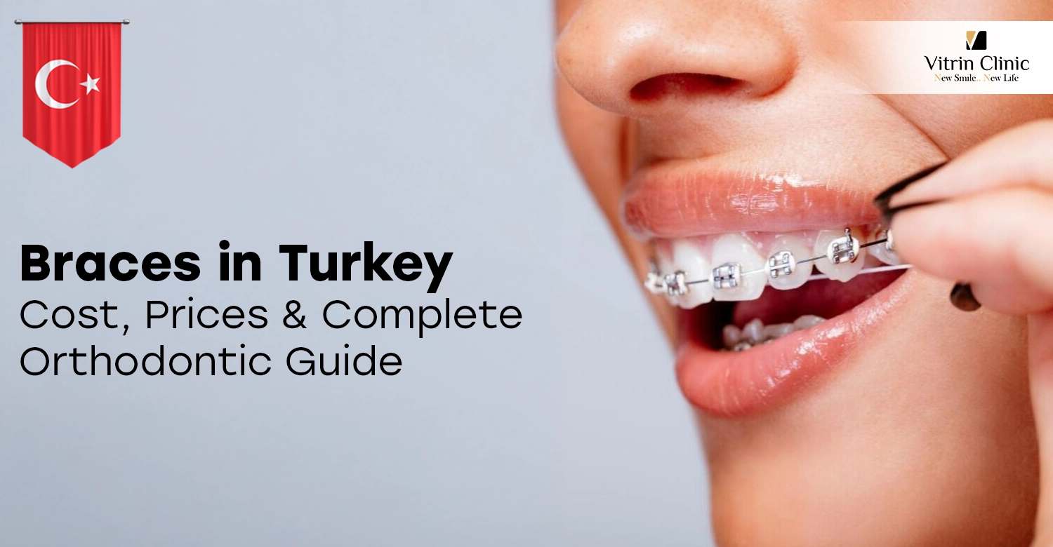 Braces in Turkey