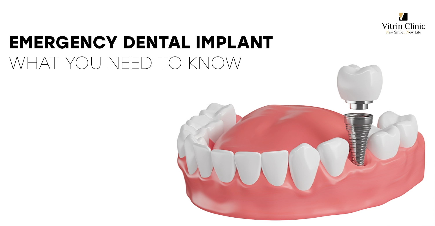 emergency dental implant