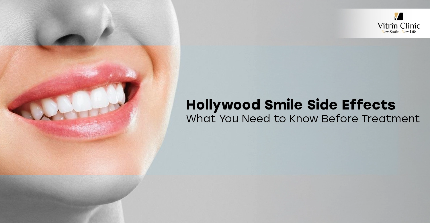 Hollywood Smile Side Effects