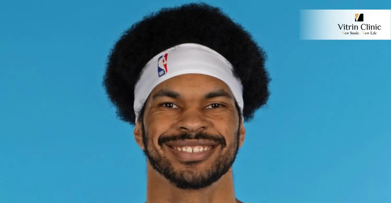 Jarrett Allen teeth