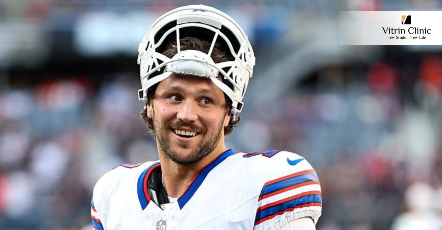 Josh Allen smile