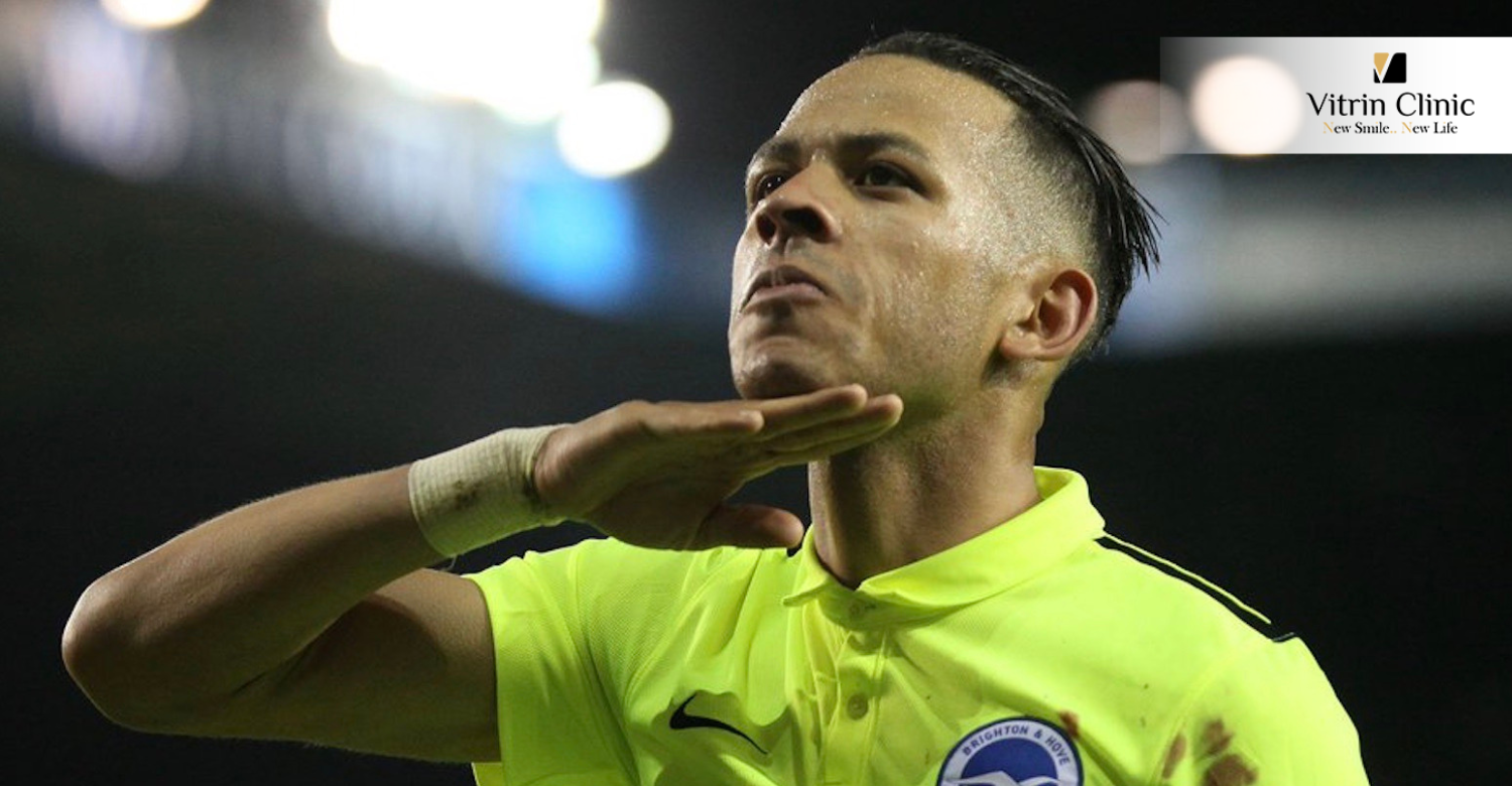 Liam Rosenior's Teeth in 2016