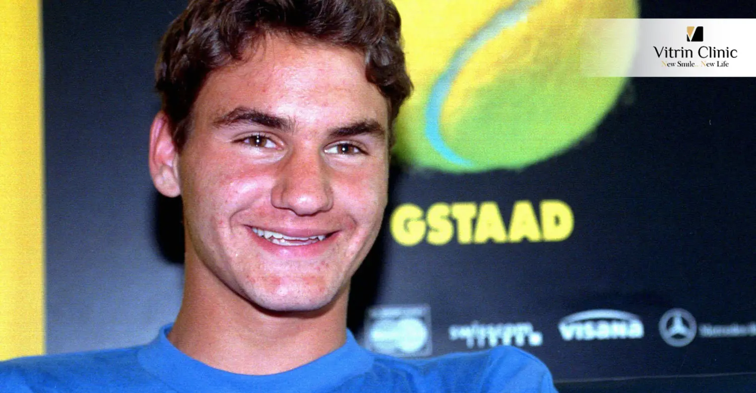 Did Roger Federer Get Dental Work?