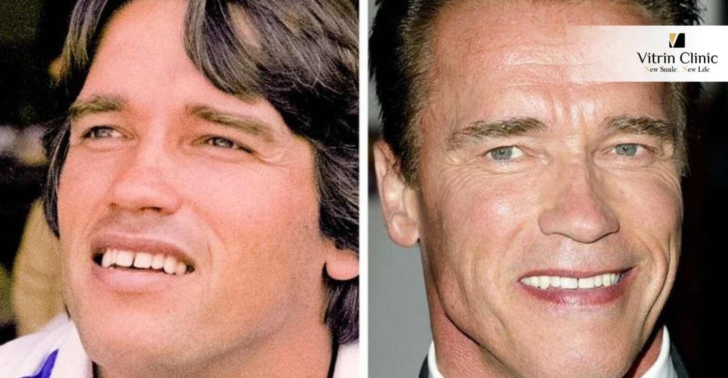 The Evolution of Arnold Schwarzenegger's Smile