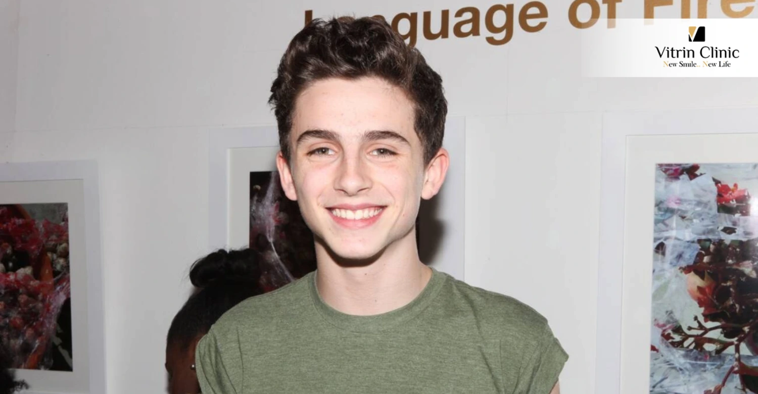 Timothée Chalamet Teeth in 2013