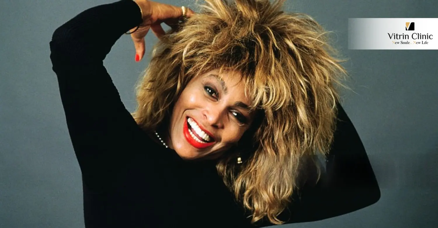 Tina Turner Smile