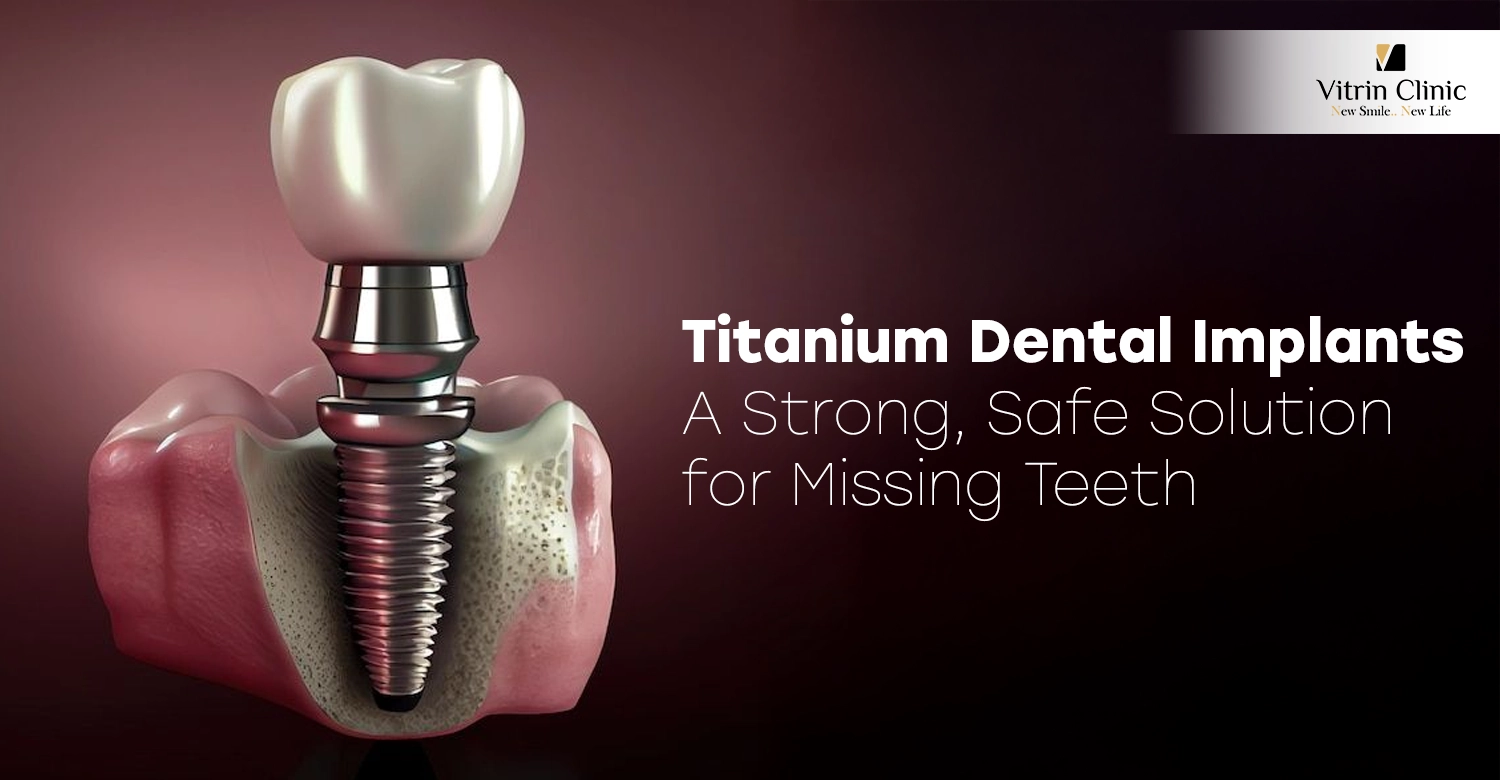 Titanium Dental Implants