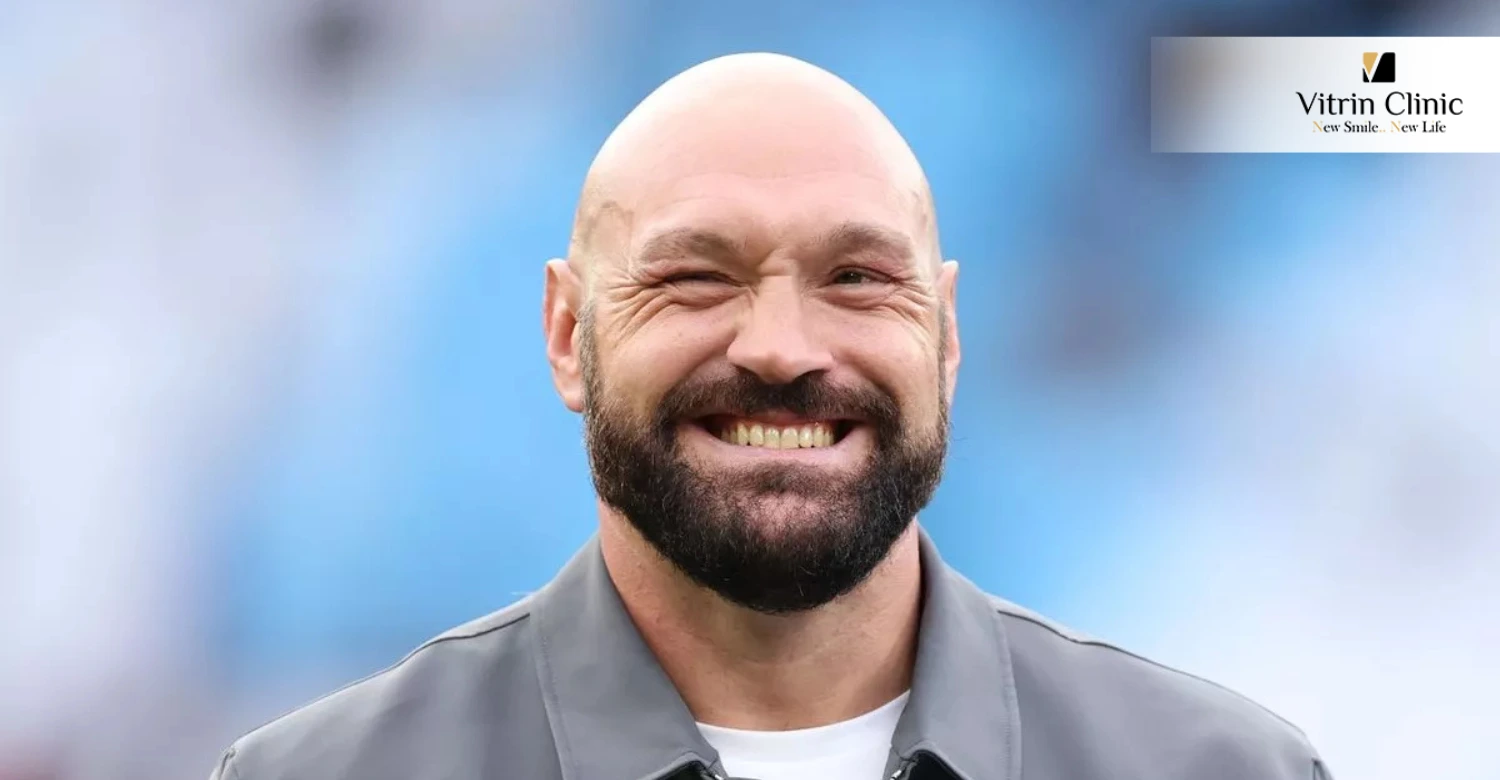 Tyson Fury's Teeth in 2025