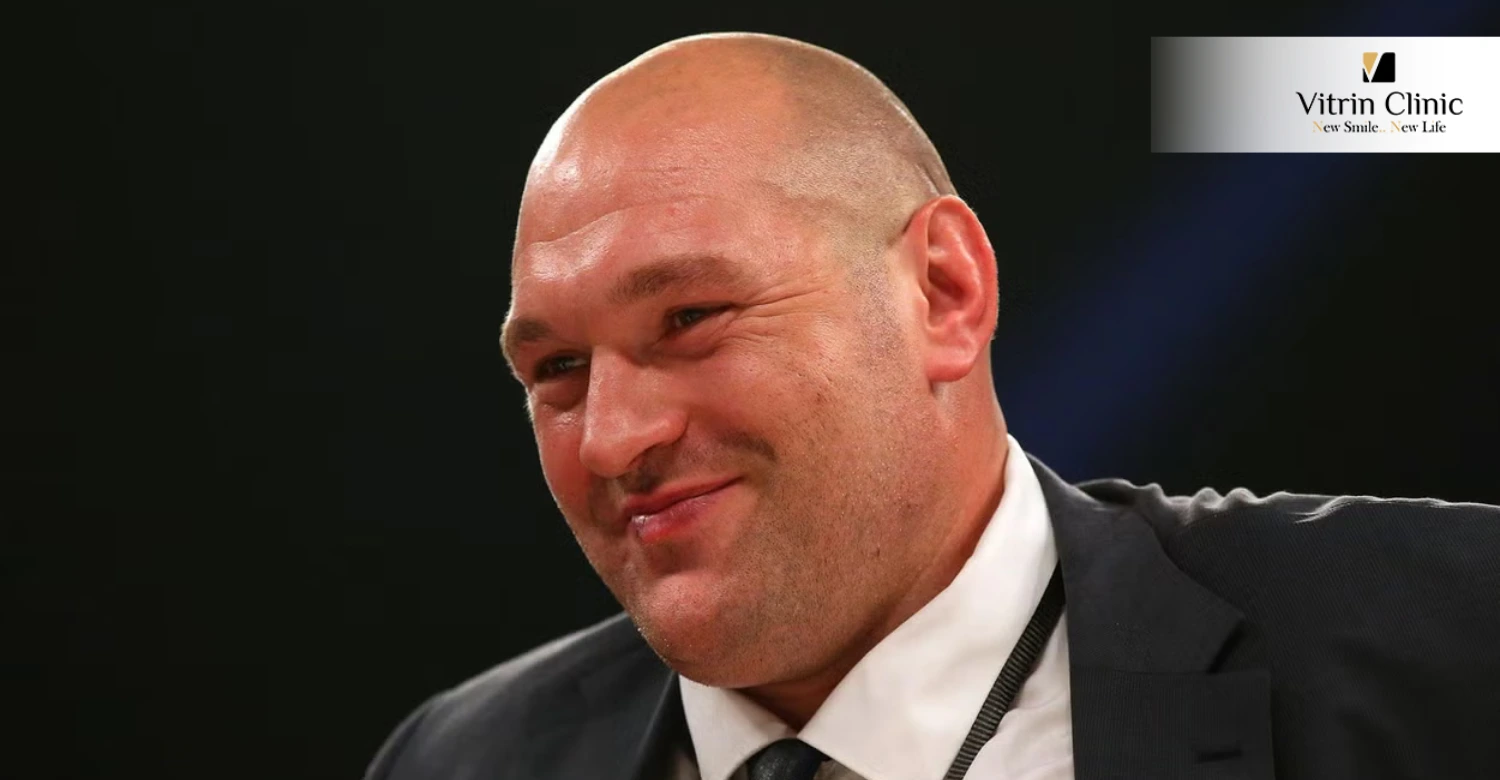 Tyson Fury's Teeth in 2016