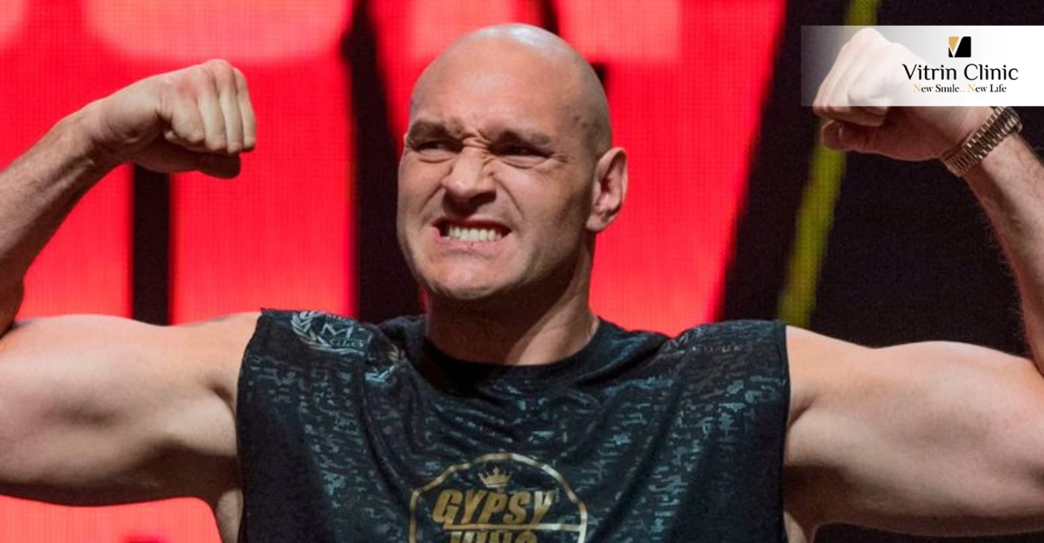 Tyson Fury's Teeth in 2020