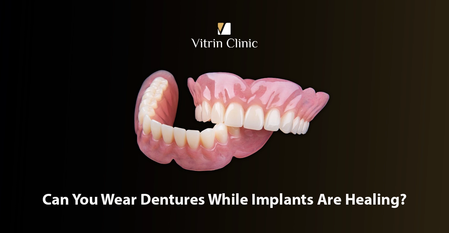 can you wear dentures while implants are healing