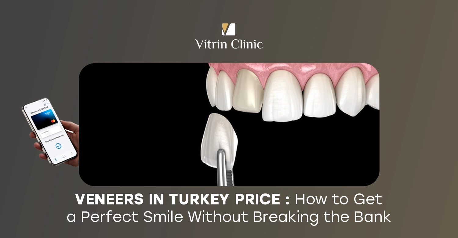 Veneers in Turkey Price: