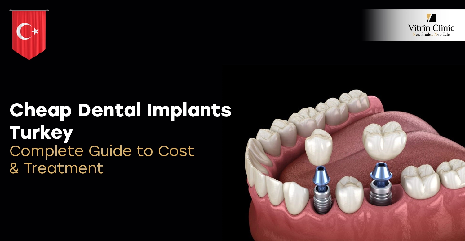 Cheap Dental Implants Turkey