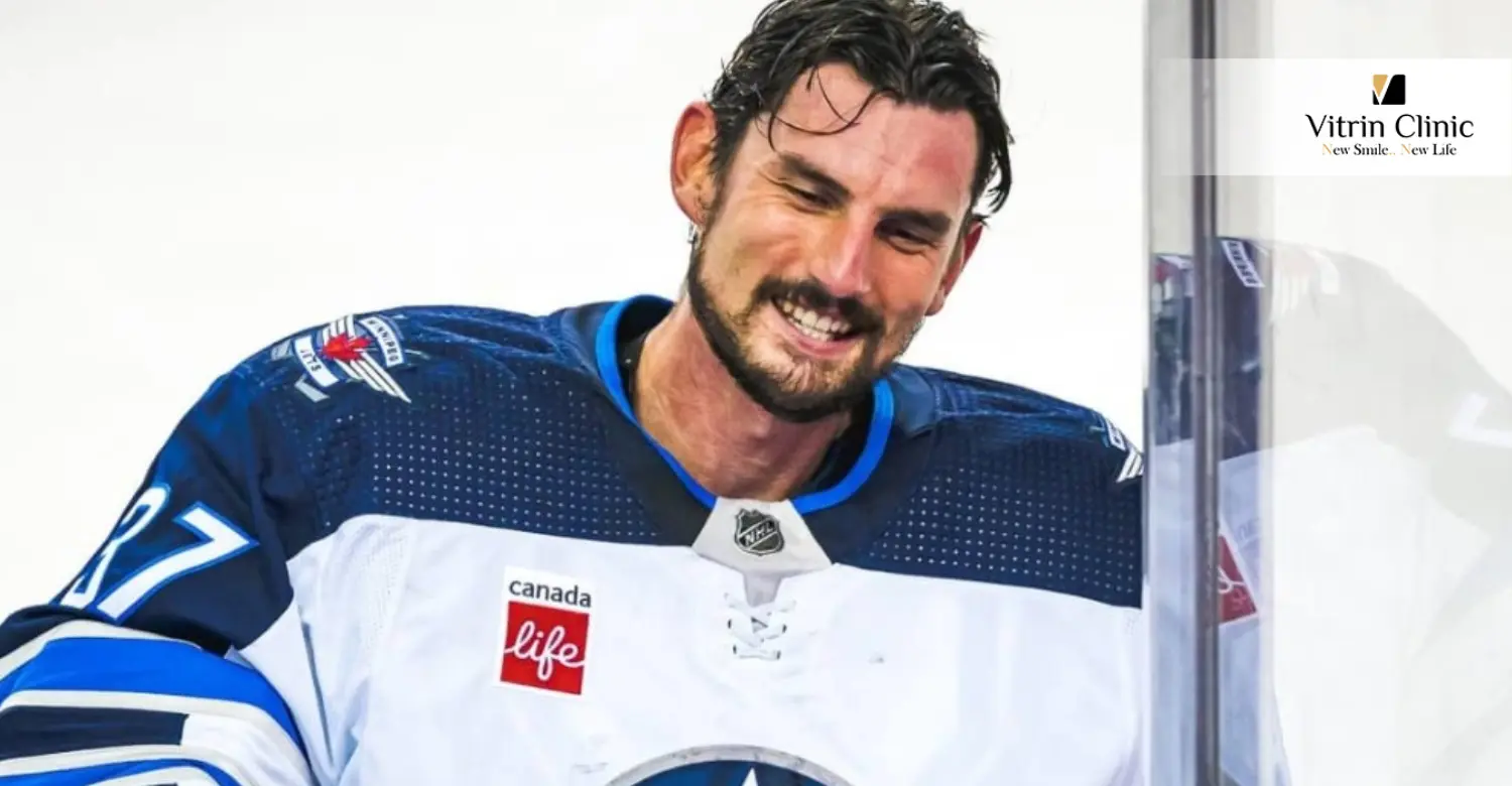 Connor Hellebuyck Teeth: Natural vs Perfect Smile
