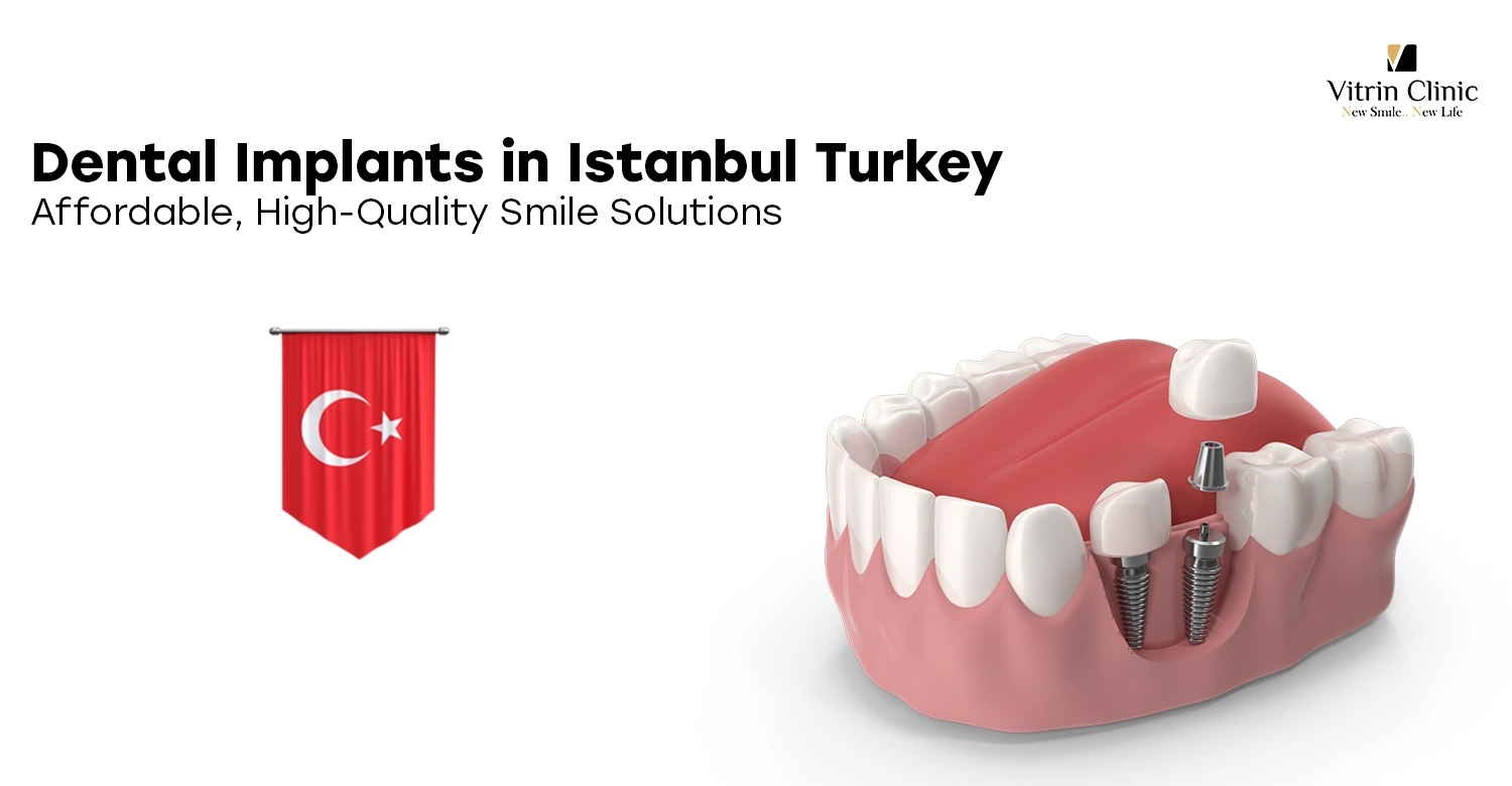 Dental Implants in Istanbul Turkey