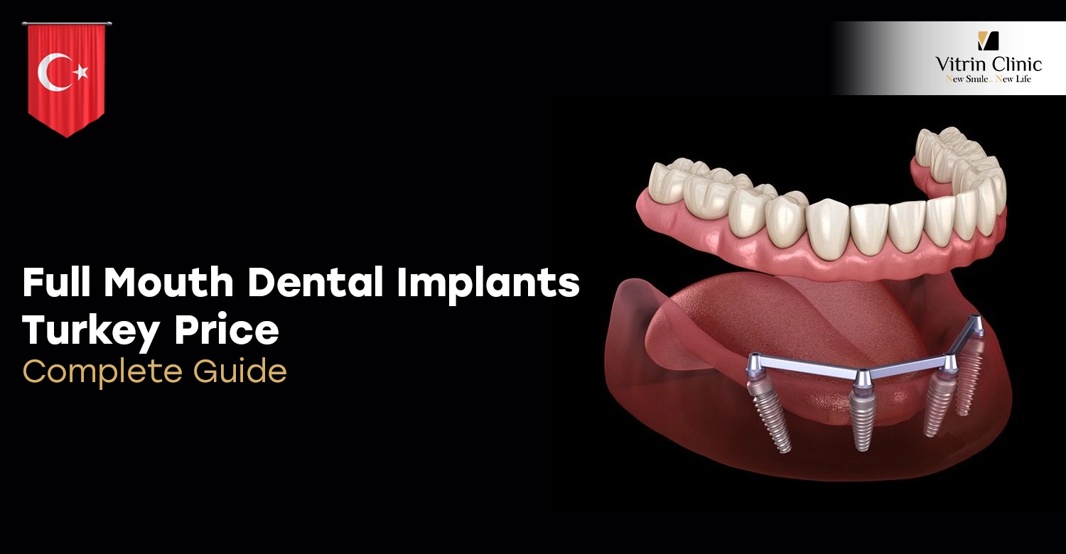 Full Mouth Dental Implants Turkey Price