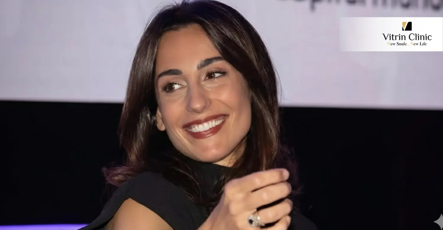 Sorriso di Giorgia Cardinaletti: Guida Completa alla Trasformazione del Suo Sorriso