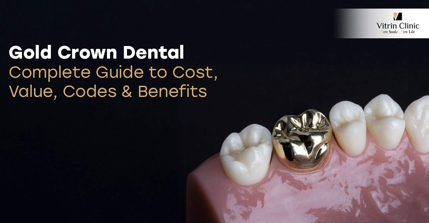 Gold Crown Dental Code: Guide to Costs & Value | Vitrin Clinic