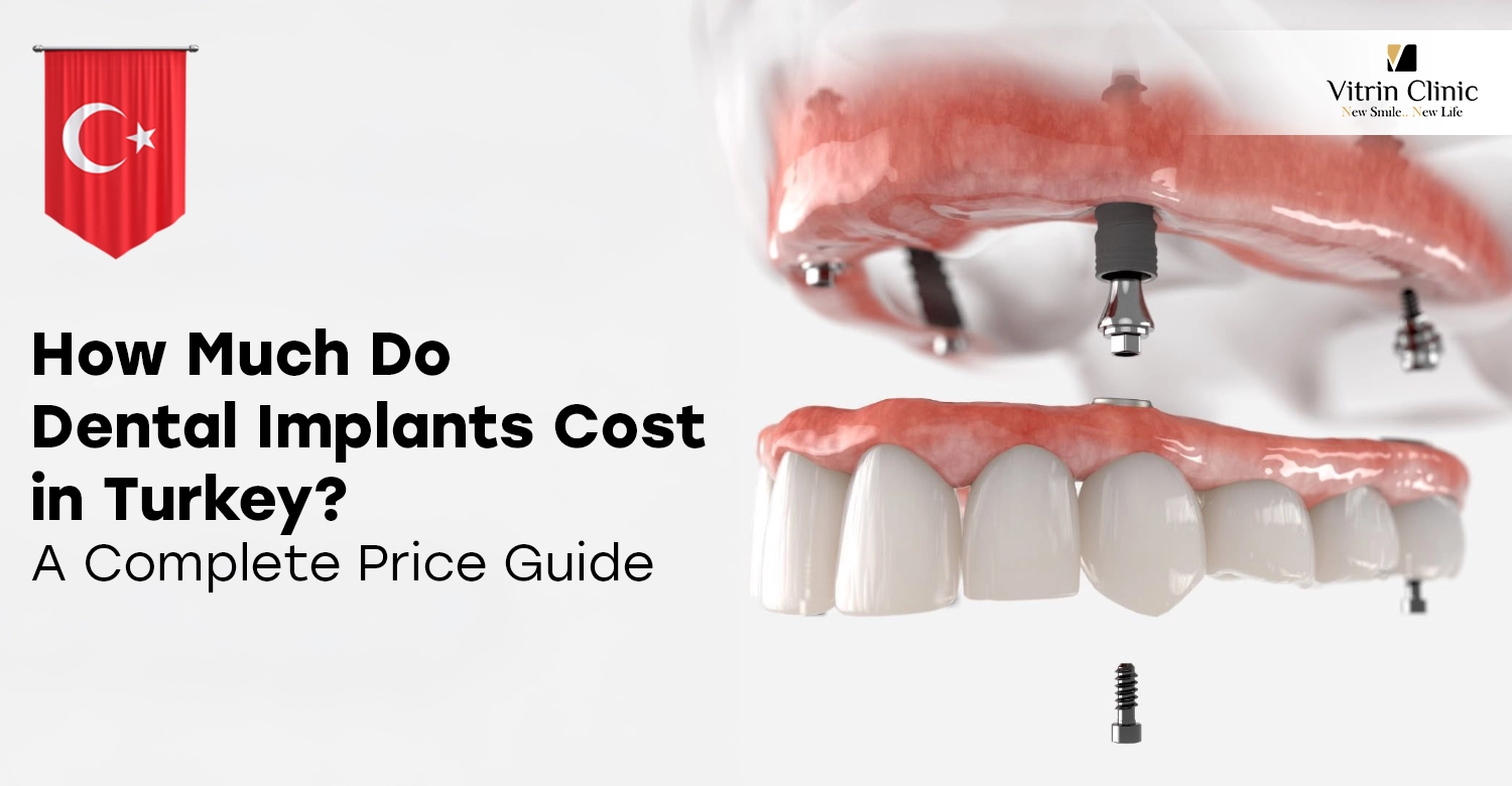 How Much Do Dental Implants Cost in Turkey