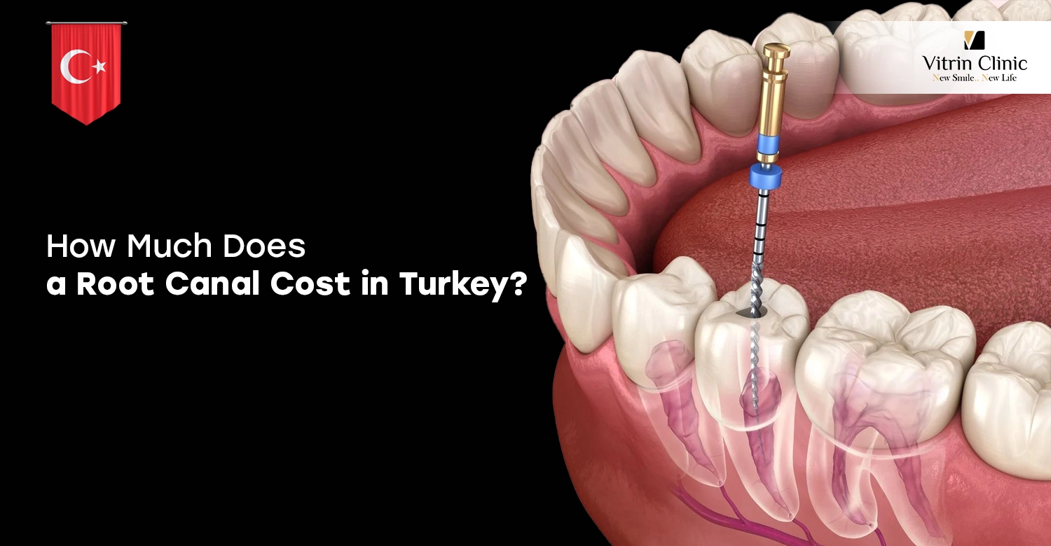 how much does a root canal cost in turkey