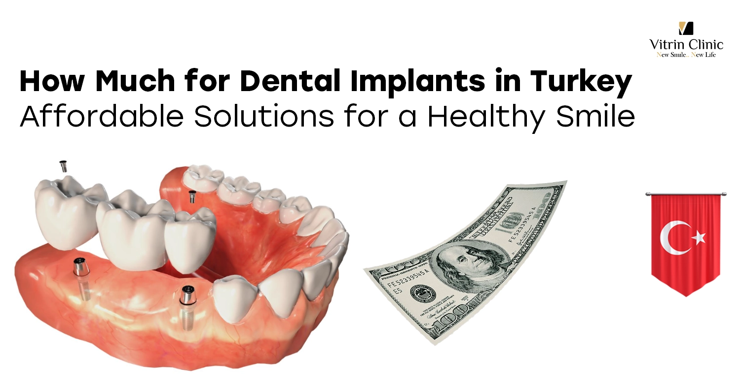 How Much for Dental Implants in Turkey