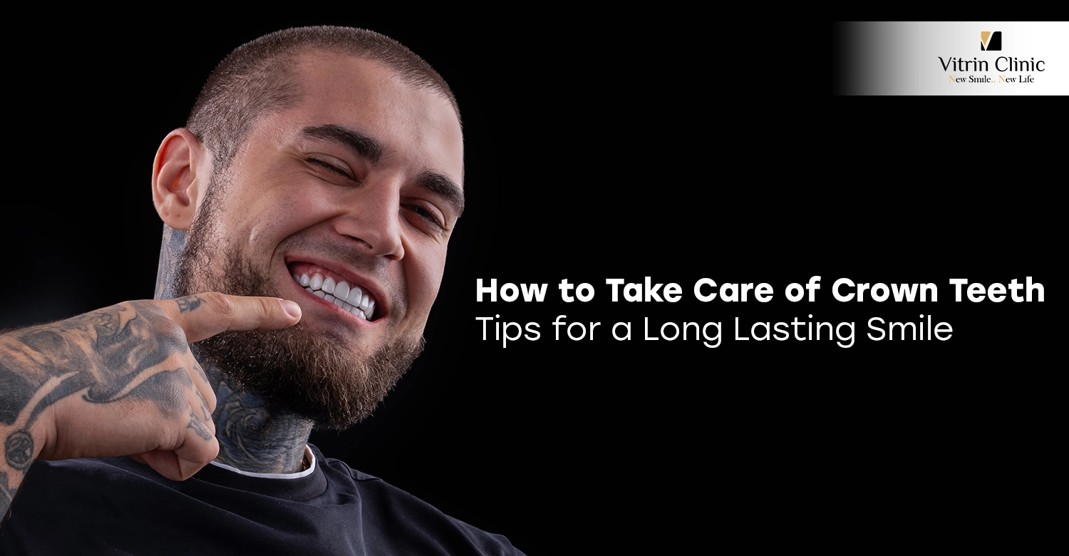 How to Take Care of Crown Teeth