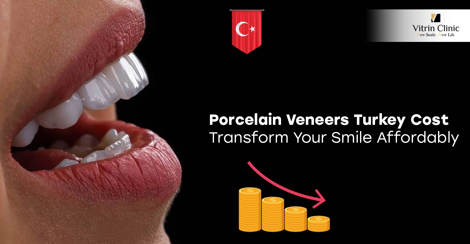 Porcelain Veneers Turkey Cost