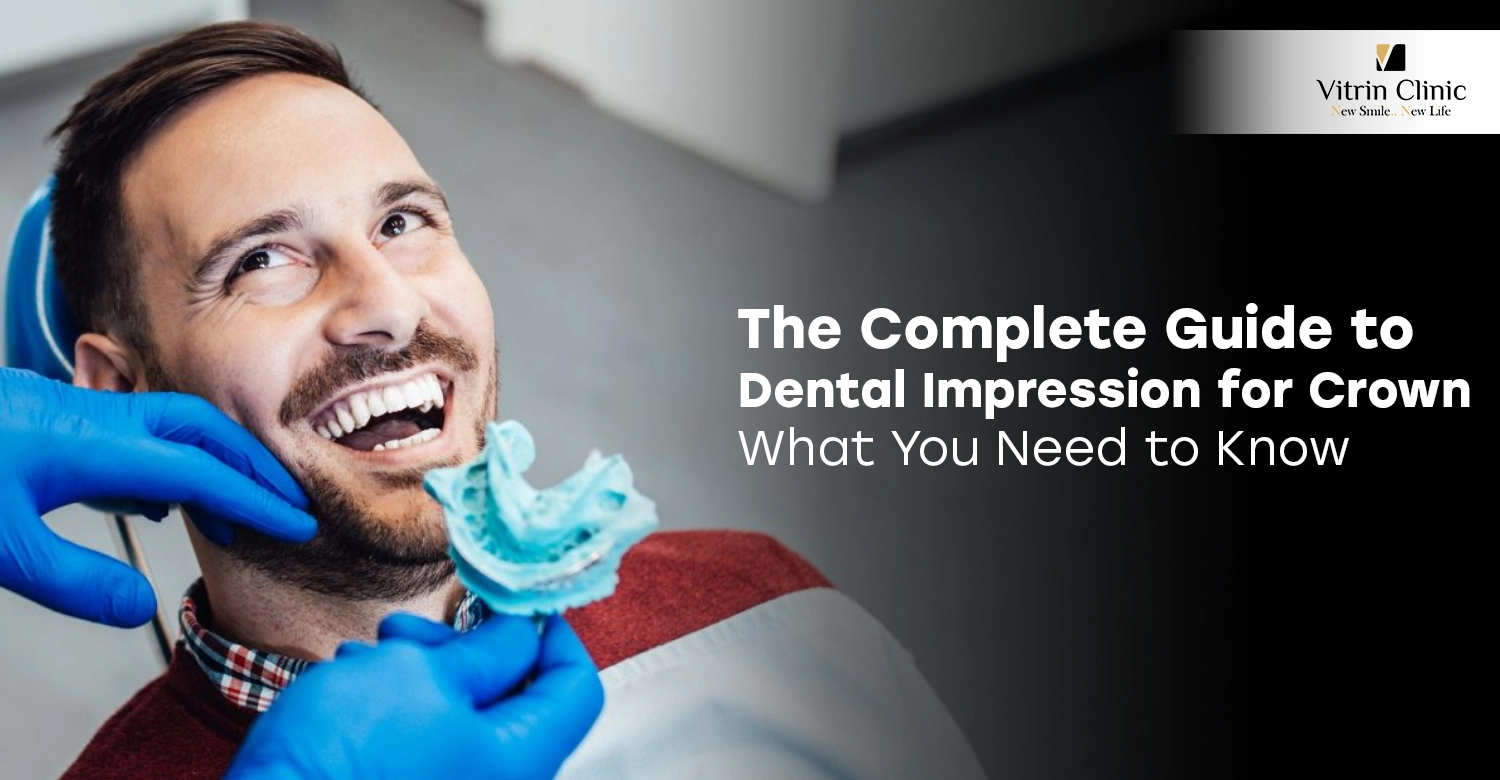 dental impression for crown