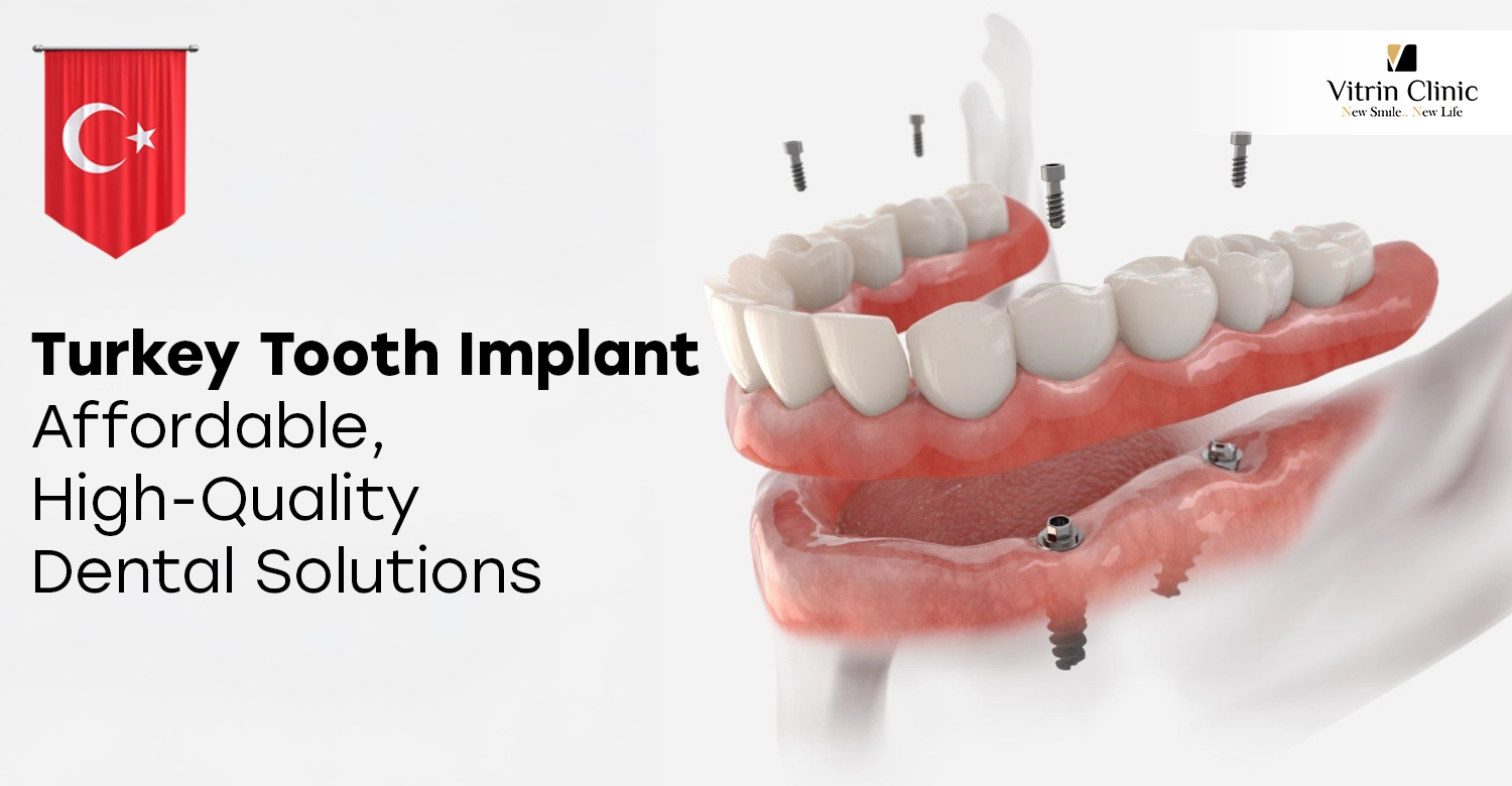 Turkey Tooth Implant