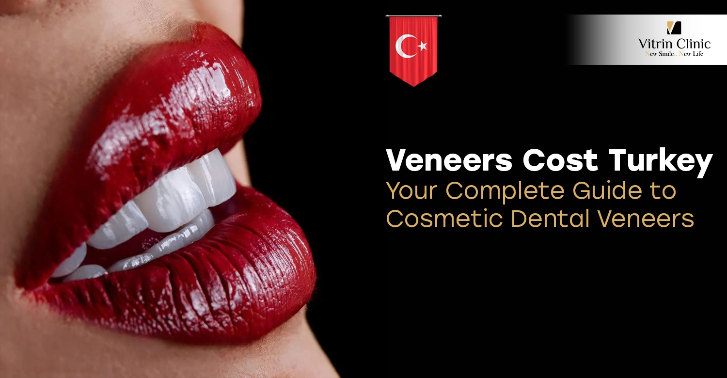 Veneers Cost Turkey