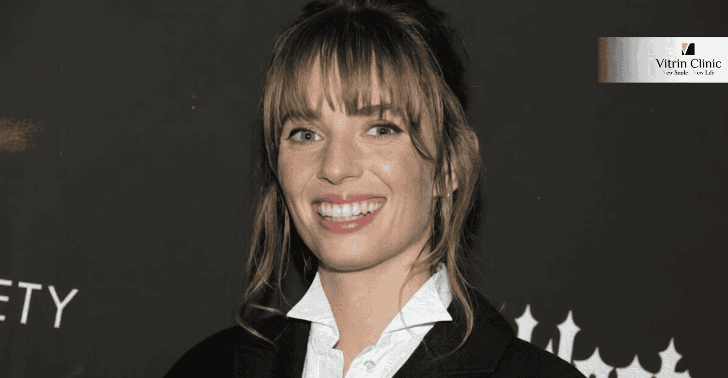 How Can You Achieve a Smile Inspired by Maya Hawke Smile?