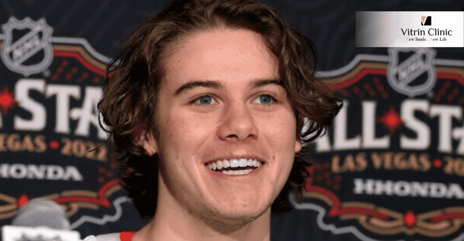 Jack Hughes Smile Makeover What Changed?