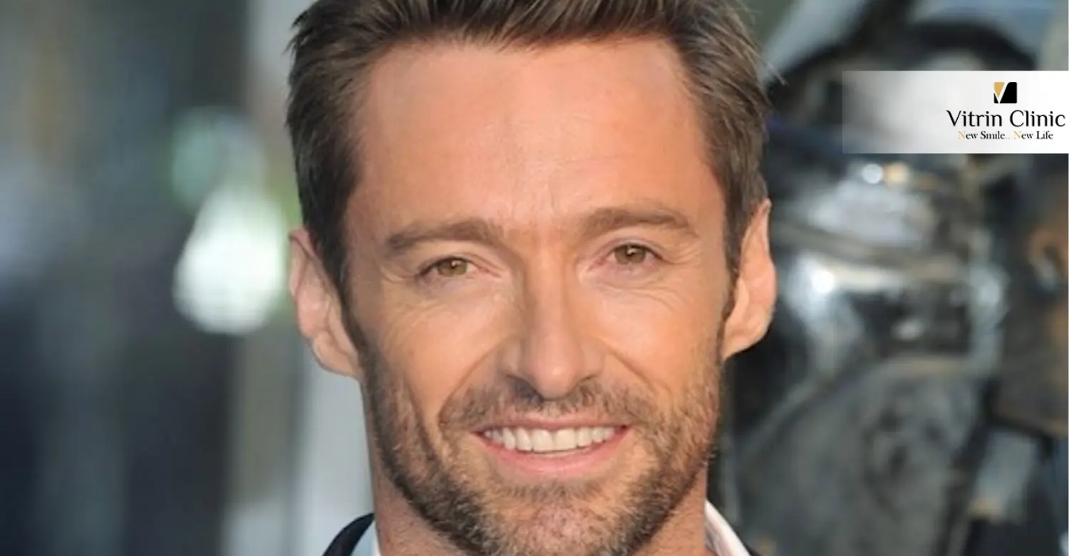 Hugh Jackman Smile