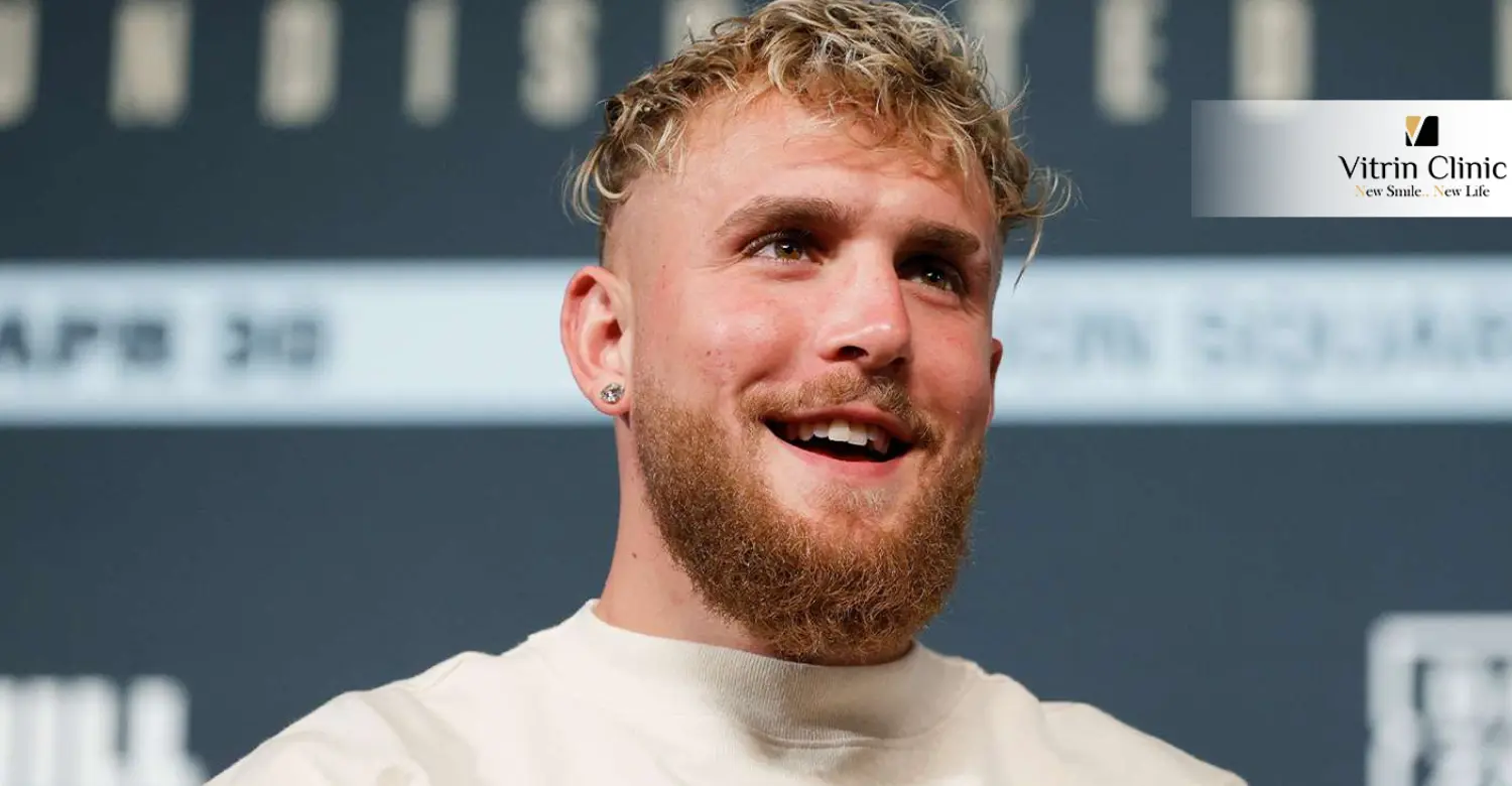 Jake Paul Teeth and Smile: A Closer Look
