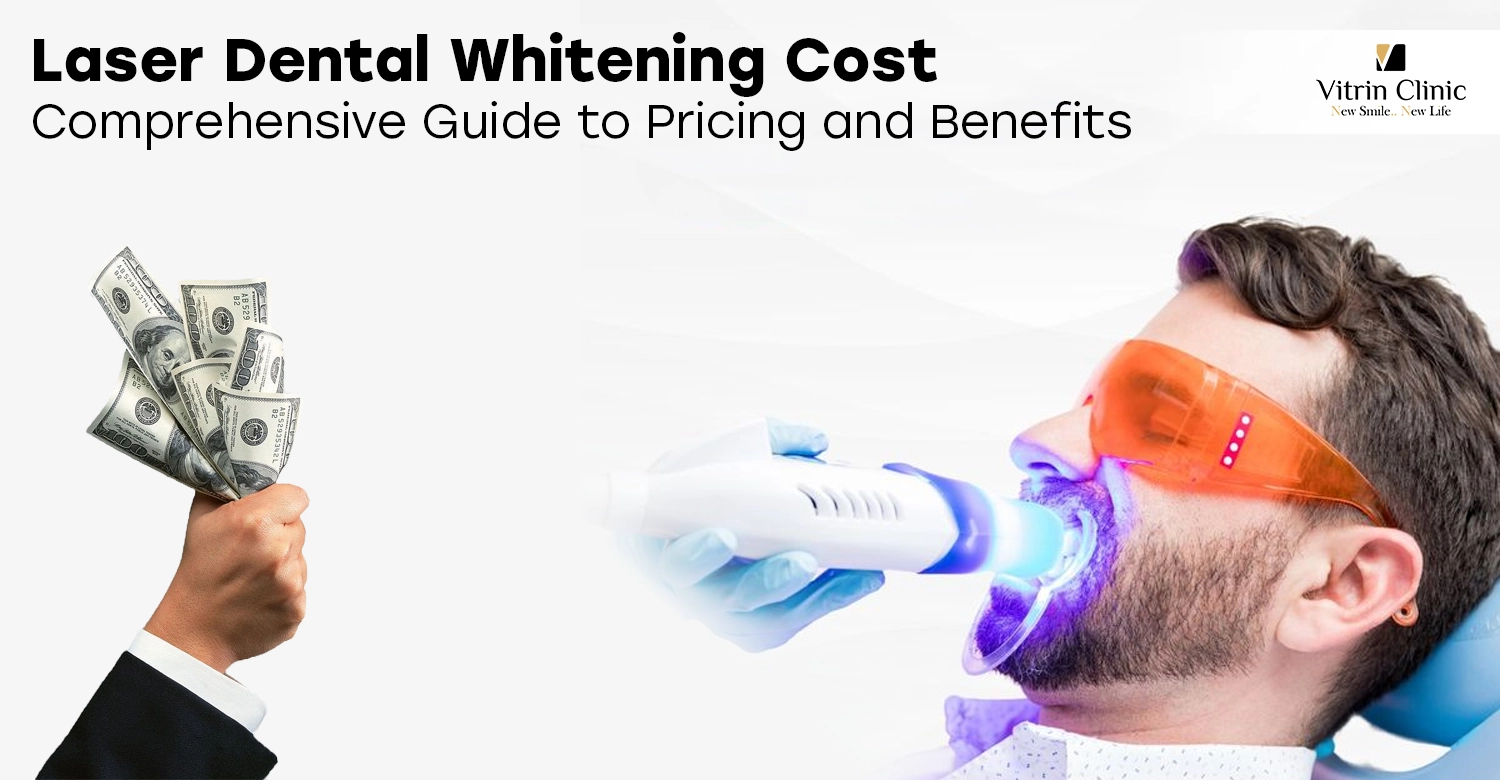 Laser Dental Whitening Cost